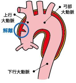 スタンフォードA