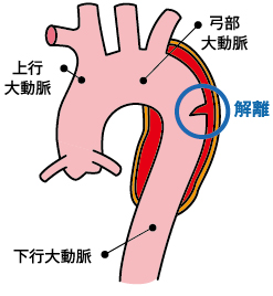 スタンフォードB